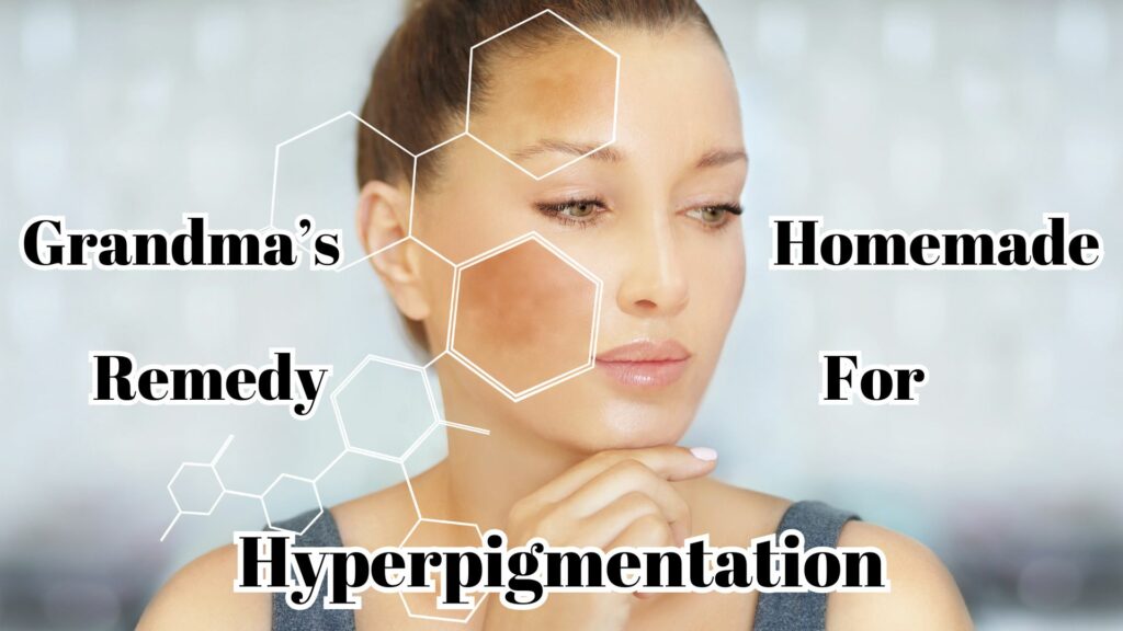 Grandma's home remedy for hyperpigmentation