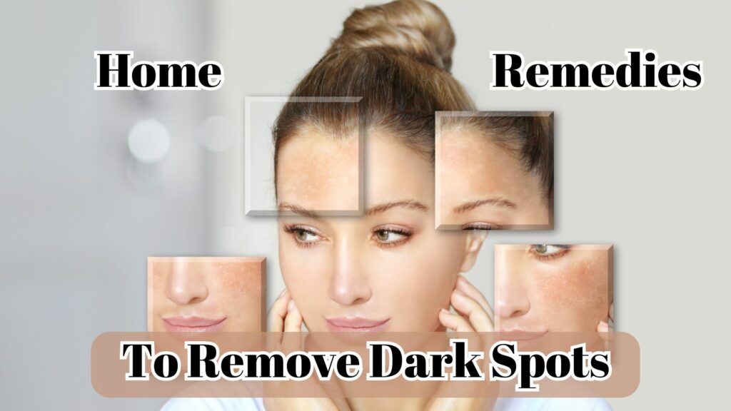 Home remedies to Remove Dark Spots