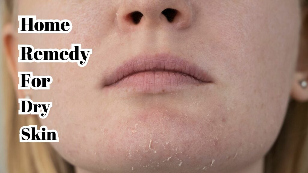 Home Remedies For Dry Skin