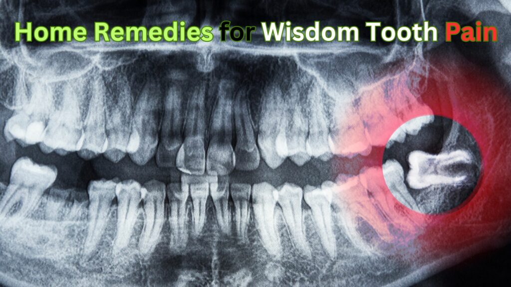 Home Remedies for Wisdom Tooth Pain